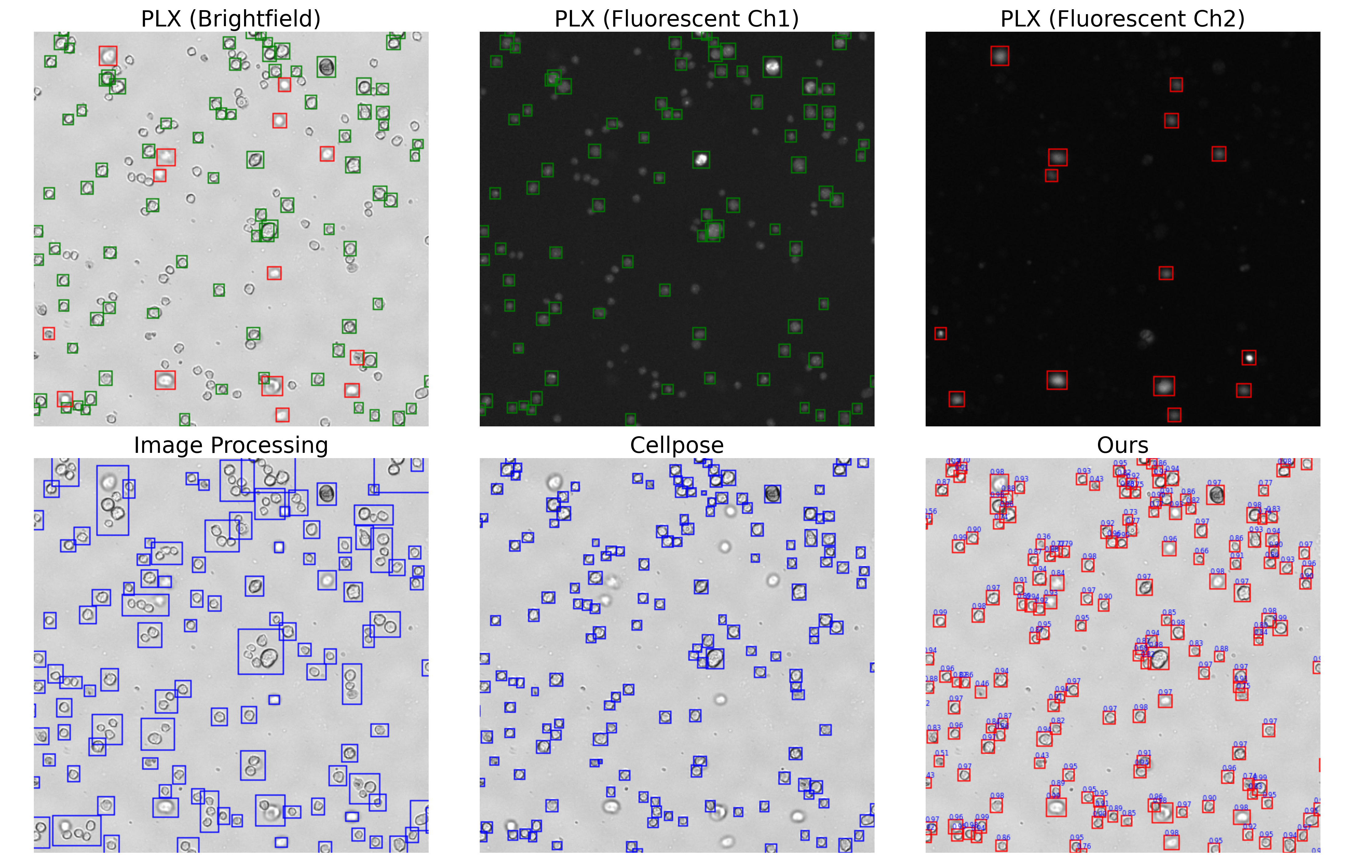 Detection results on stained sample 1